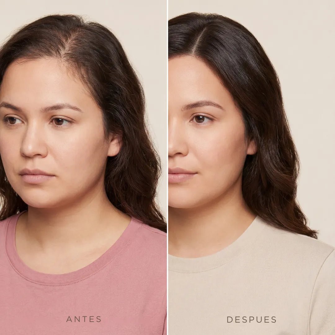 CapilRoot Pro - Recupera tu cabello y tu confianza en casa, sin químicos ni pastillas